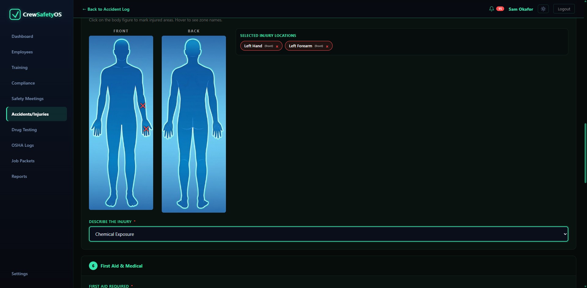 Filing an accident report, marking injured areas on a front and back body diagram